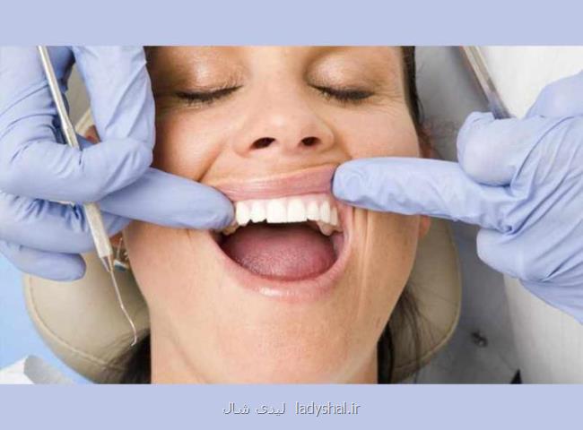 جراحی لثه در مطب دکتر الهوردیزاده